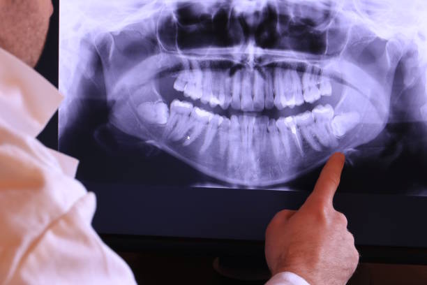 Teeth Whitening in WV