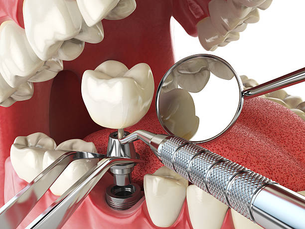 Best Urgent Tooth Repair  in Prosperity, WV